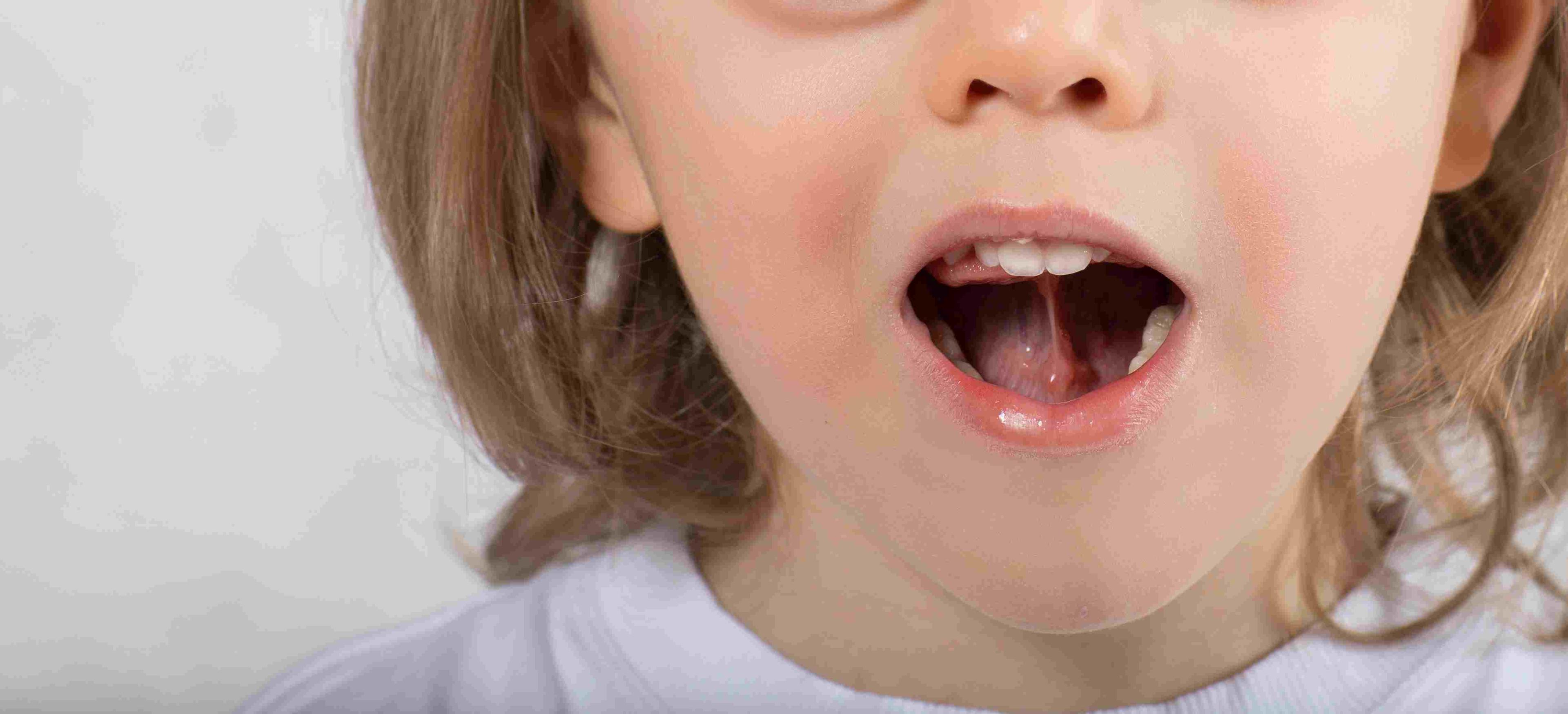 Tongue Tips